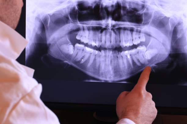 Emergency Treatment for Jaw Pain or Injury